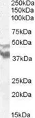 Anti-DYX1C1 antibody, N-term used in Western Blot (WB). GTX88749