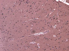 Anti-DHX58 antibody, C-term used in IHC (Paraffin sections) (IHC-P). GTX88752