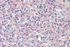 Anti-TRIB1 antibody, C-term used in IHC (Paraffin sections) (IHC-P). GTX88755