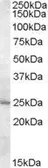 Anti-MTHFS antibody, Internal used in Western Blot (WB). GTX88772