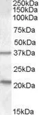 Anti-TUSC3 antibody, Internal used in Western Blot (WB). GTX88807