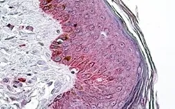 Anti-PNPLA3 antibody, Internal used in IHC (Paraffin sections) (IHC-P). GTX88810