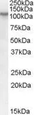 Anti-BOC antibody, Internal used in Western Blot (WB). GTX88814