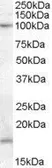 Anti-TEB4 / MARCH-VI (aa 701 to 712) antibody, Internal used in Western Blot (WB). GTX88852