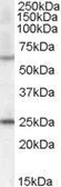 Anti-COL4A3BP (aa662-672) antibody, Internal used in Western Blot (WB). GTX88855
