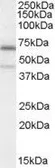 Anti-C14orf169 / NO66 antibody, Internal used in Western Blot (WB). GTX88860