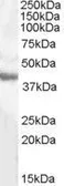 Anti-GOT1 (aa 22-35) antibody, Internal used in Western Blot (WB). GTX88903