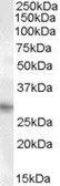 Anti-PRRX1 antibody, Internal used in Western Blot (WB). GTX88910