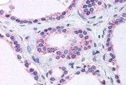 Anti-RPL22 antibody, C-term used in IHC (Paraffin sections) (IHC-P). GTX88916