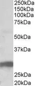 Anti-B7-H4 antibody, Internal used in Western Blot (WB). GTX88996