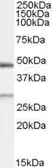 Anti-BNIP1 antibody, Internal used in Western Blot (WB). GTX89008