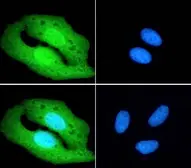 Anti-PGC1 alpha antibody, Internal used in Immunocytochemistry/ Immunofluorescence (ICC/IF). GTX89046