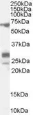 Anti-SALL4 antibody, Internal used in Western Blot (WB). GTX89069
