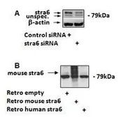 Anti-STRA6 (mouse, rat) antibody, C-term used in Western Blot (WB). GTX89070