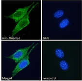 Anti-TIP47 antibody, Internal used in Immunocytochemistry/ Immunofluorescence (ICC/IF). GTX89106