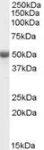 Anti-TRAF2 antibody, C-term used in Western Blot (WB). GTX89120