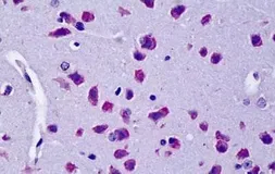 Anti-CYLD antibody, Internal used in IHC (Paraffin sections) (IHC-P). GTX89126