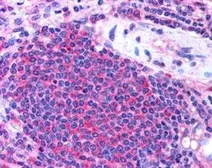 Anti-UBASH3A antibody, Internal used in IHC (Paraffin sections) (IHC-P). GTX89140