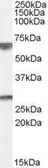 Anti-GPSM2 antibody, Internal used in Western Blot (WB). GTX89175