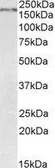 Anti-ROBO1 antibody, Internal used in Western Blot (WB). GTX89225