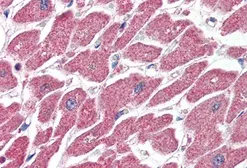 Anti-CPT1A antibody, Internal used in IHC (Paraffin sections) (IHC-P). GTX89237