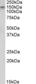 Anti-KALRN antibody, C-term used in Western Blot (WB). GTX89287