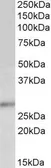 Anti-p27 Kip1 antibody, C-term used in Western Blot (WB). GTX89293