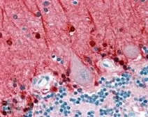 Anti-Amphiphysin antibody, Internal used in IHC (Paraffin sections) (IHC-P). GTX89317