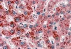Anti-HSD3a antibody, N-term used in IHC (Paraffin sections) (IHC-P). GTX89330