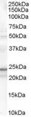 Anti-TIRAP antibody, Internal used in Western Blot (WB). GTX89359