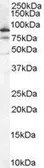 Anti-Ku80 antibody, Internal used in Western Blot (WB). GTX89363