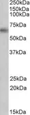 Anti-Monoamine Oxidase B antibody, Internal used in Western Blot (WB). GTX89368