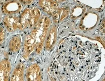 Anti-TRIM5 (alpha isoform) antibody, Internal used in IHC (Paraffin sections) (IHC-P). GTX89426