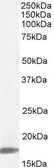 Anti-Cyclophilin A antibody, Internal used in Western Blot (WB). GTX89433
