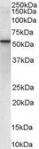 Anti-VPS45 antibody, Internal used in Western Blot (WB). GTX89447
