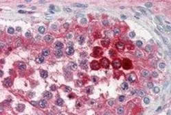 Anti-Clusterin antibody, C-term used in IHC (Paraffin sections) (IHC-P). GTX89492