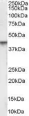 Anti-Vitamin D Receptor antibody, Internal used in Western Blot (WB). GTX89509