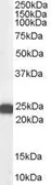 Anti-BAG2 antibody, C-term used in Western Blot (WB). GTX89538