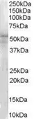 Anti-IRAK4 antibody, N-term used in Western Blot (WB). GTX89550