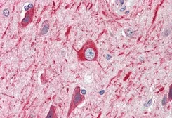 Anti-PRDM11 antibody, C-term used in IHC (Paraffin sections) (IHC-P). GTX89551