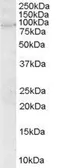 Anti-ARHGEF4 antibody, N-term used in Western Blot (WB). GTX89645