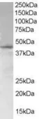 Anti-SAMSN1 antibody, N-term used in Western Blot (WB). GTX89694