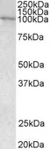 Anti-VAV3 antibody, Internal used in Western Blot (WB). GTX89695