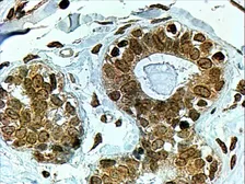 Anti-CYP7B1 antibody, C-term used in IHC (Paraffin sections) (IHC-P). GTX89711