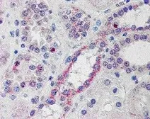 Anti-NOXO1 antibody, C-term used in IHC (Paraffin sections) (IHC-P). GTX89749