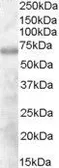 Anti-DEF6 antibody, N-term used in Western Blot (WB). GTX89758