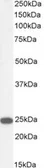 Anti-Transgelin antibody, C-term used in Western Blot (WB). GTX89789