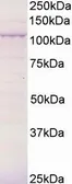 Anti-BCAR3 antibody, C-term used in Western Blot (WB). GTX89796