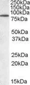 Anti-TRIM3 antibody, N-term used in Western Blot (WB). GTX89826
