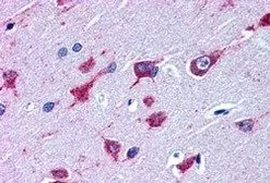 Anti-ALS2 antibody, C-term used in IHC (Paraffin sections) (IHC-P). GTX89837